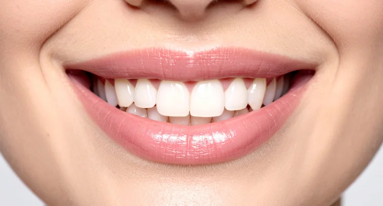 Professional Hygiene for White Teeth at Dental Care Center